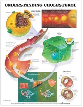 Understanding Cholesterol Large - Anatomy Charts